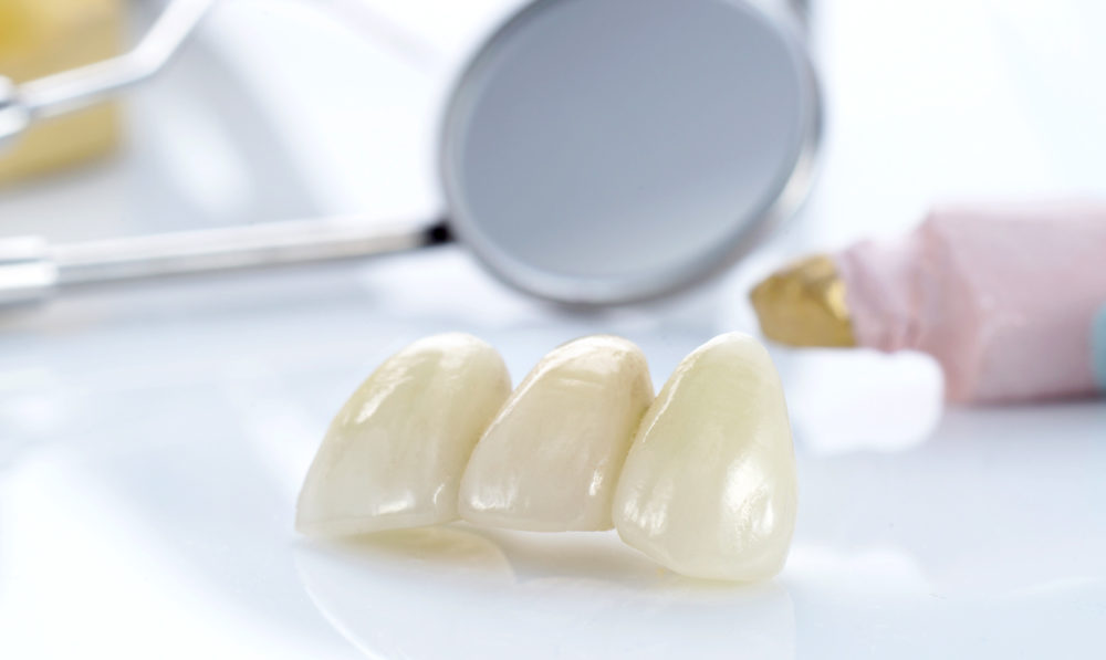 установка коронок на зубы: Dental Studio