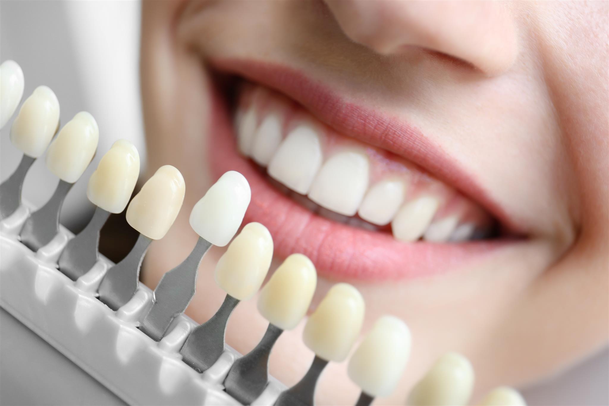 Стоматология в Днепре - Dental Studio