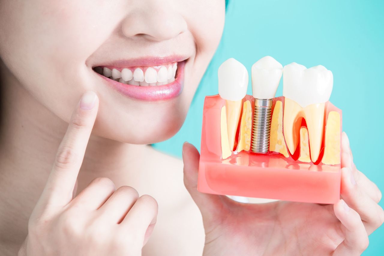 Стоматология в Днепре - Dental Studio
