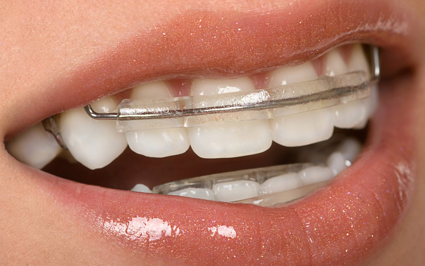 Стоматология в Днепре - Dental Studio
