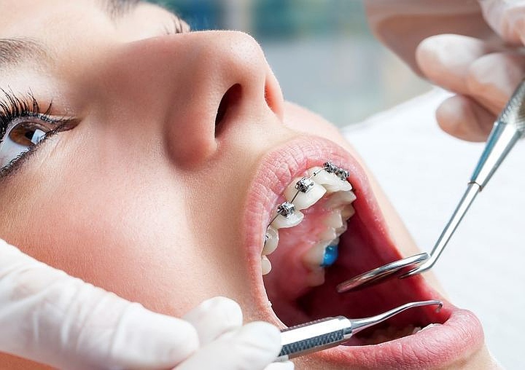 Стоматология в Днепре - Dental Studio