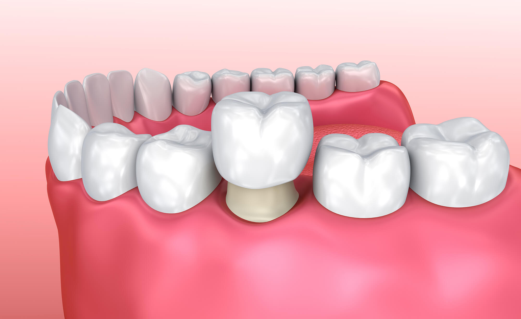 Стоматология в Днепре - Dental Studio