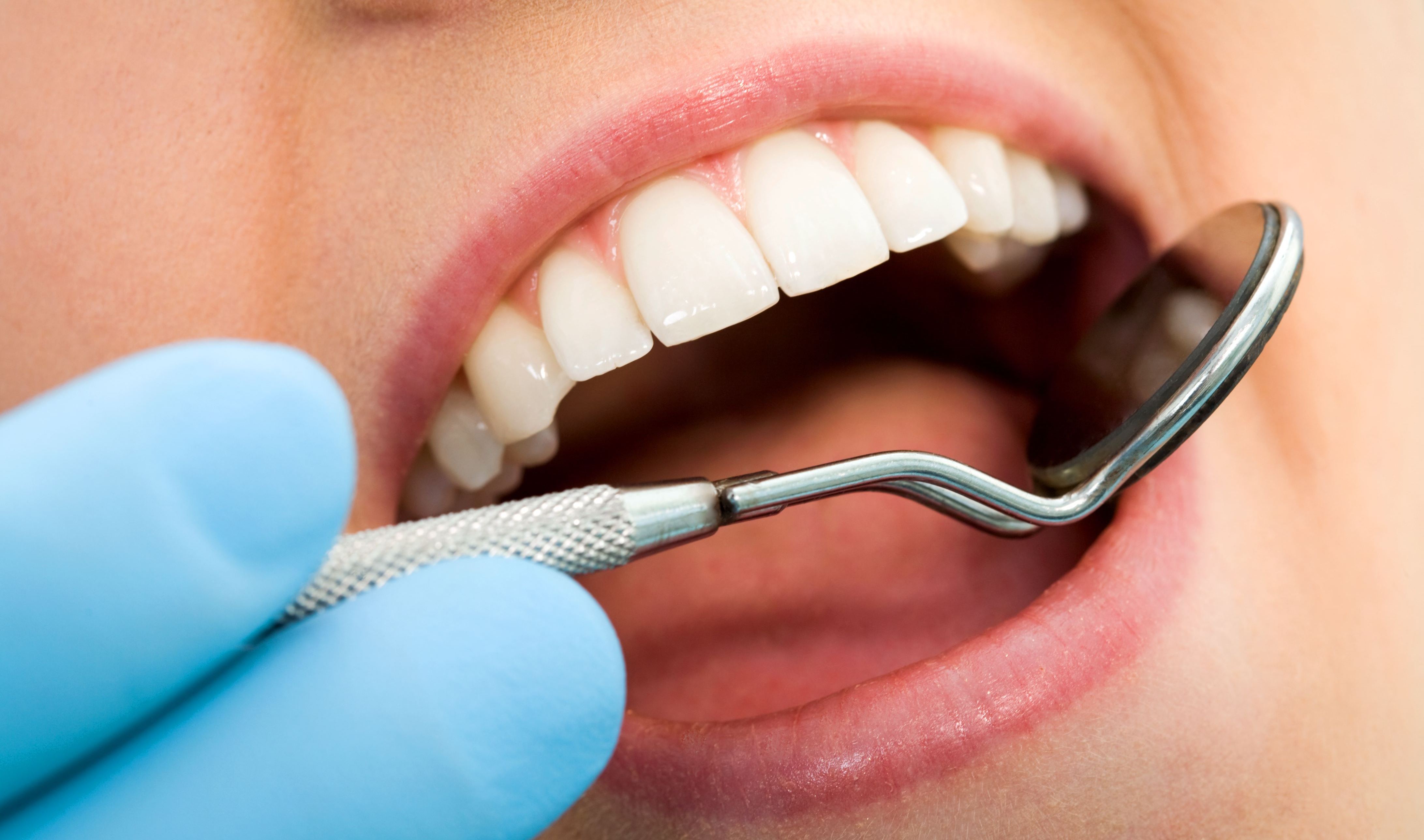 Стоматология в Днепре - Dental Studio