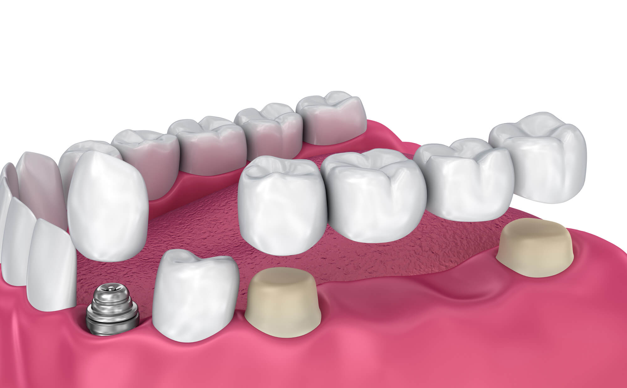 Стоматология в Днепре - Dental Studio