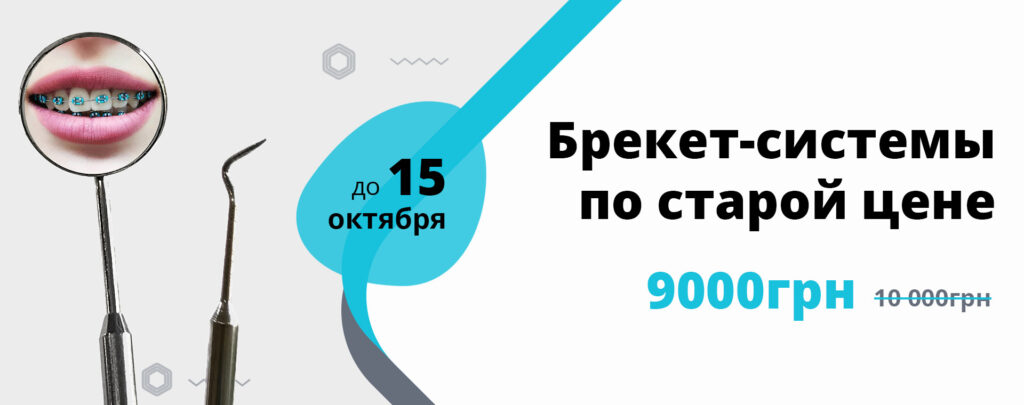 Брекет-системы по старой цене