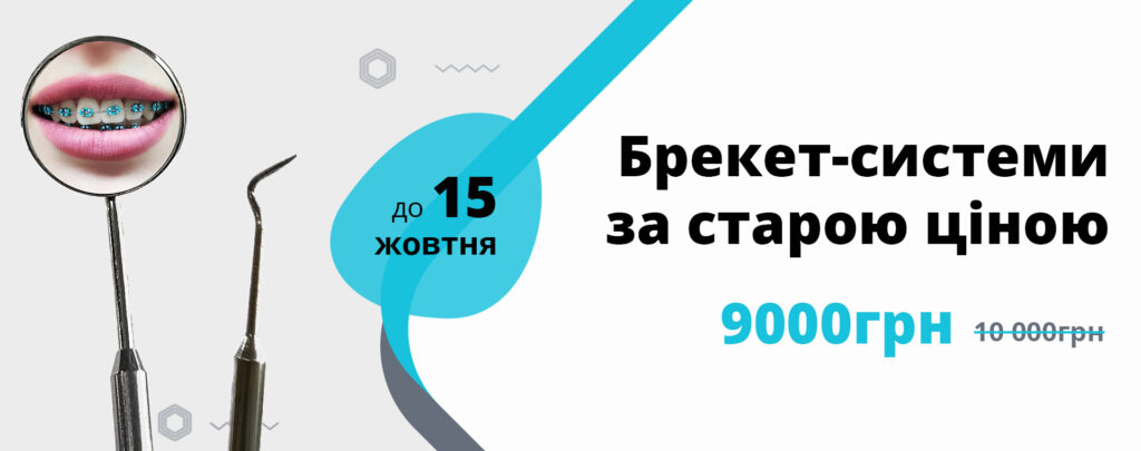 Брекет-системи за старою ціною