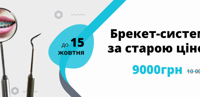 Брекет-системи за старою ціною