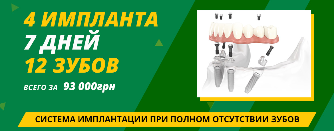 4 Импланта 7 дней RU