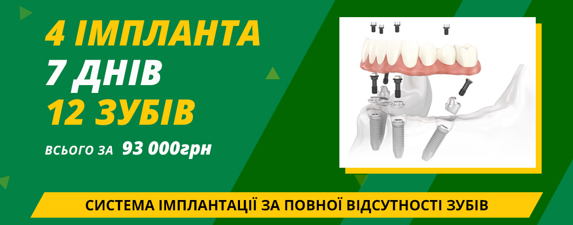 4 Импланта 7 дней UA