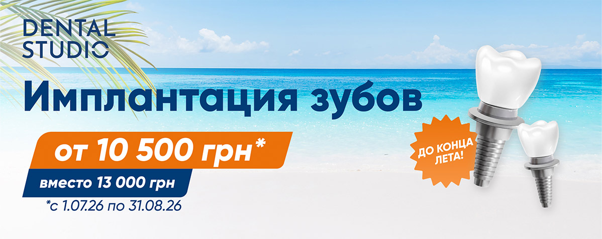Имплантация зубов со скидкой