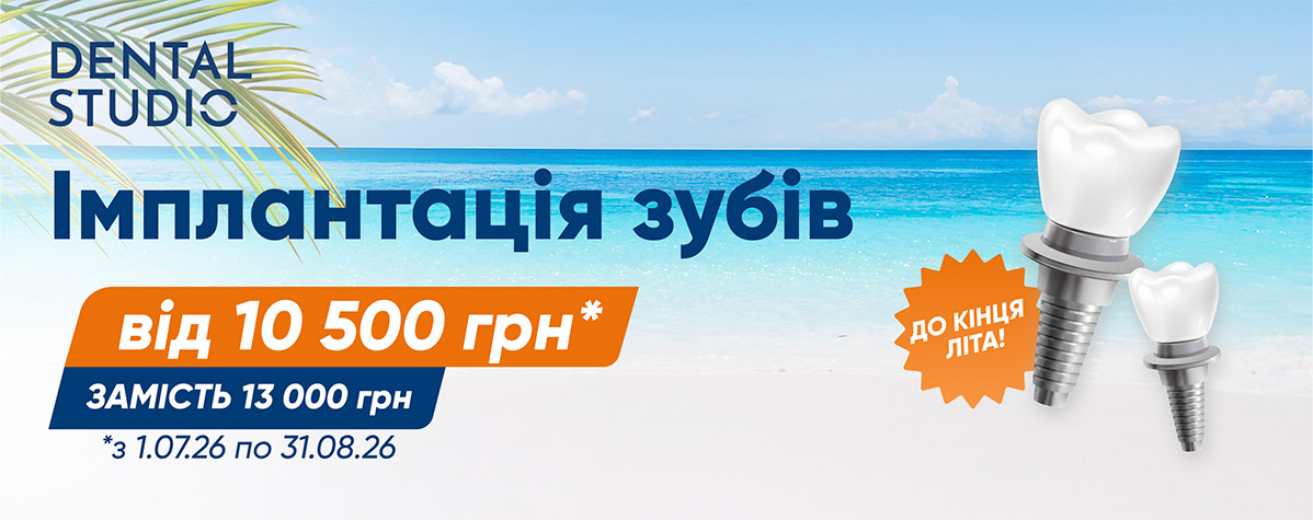 Імплантація зубів зі знижкою